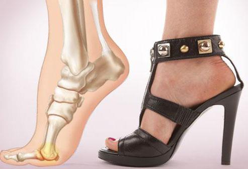 pain in the foot when walking causes and treatment
